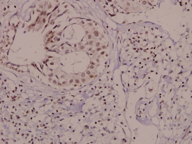 Phospho-VAV1 (Tyr174) Antibody in Immunohistochemistry (Paraffin) (IHC (P))