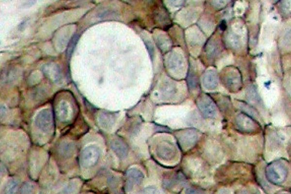 Phospho-VEGF Receptor 2 (Tyr951) Antibody in Immunohistochemistry (Paraffin) (IHC (P))