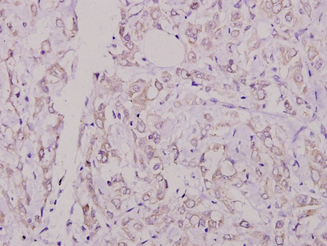Phospho-Caspase 8 (Ser347) Antibody in Immunohistochemistry (Paraffin) (IHC (P))