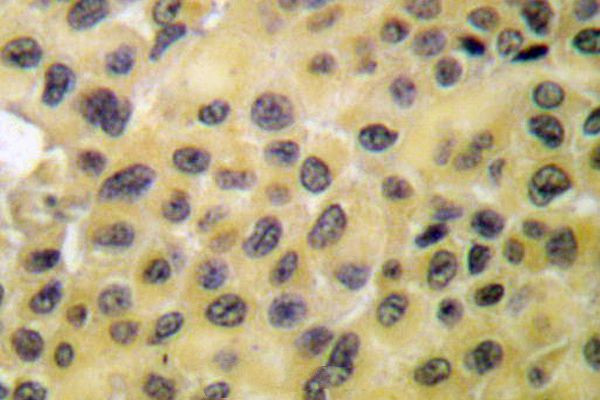 Phospho-GRF-1 (Tyr1105) Antibody in Immunohistochemistry (Paraffin) (IHC (P))