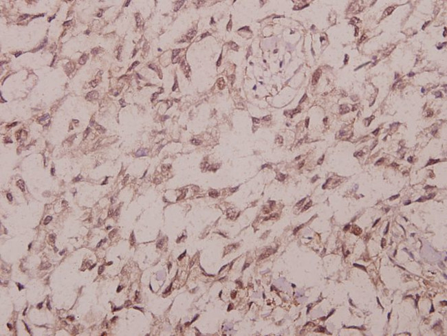 Phospho-IRS1 (Ser1101) Antibody in Immunohistochemistry (Paraffin) (IHC (P))