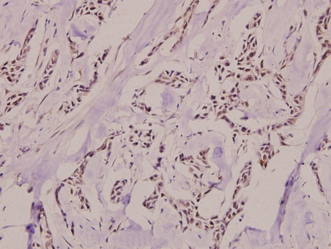 Phospho-Ku80 (Thr714) Antibody in Immunohistochemistry (Paraffin) (IHC (P))