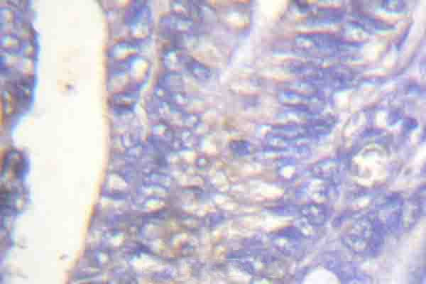 Phospho-PLCG2 (Tyr753) Antibody in Immunohistochemistry (Paraffin) (IHC (P))