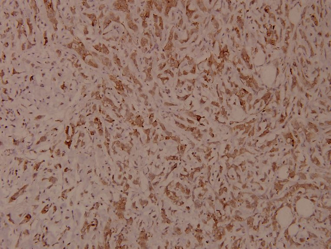 Phospho-ITGB1 (Thr788) Antibody in Immunohistochemistry (Paraffin) (IHC (P))