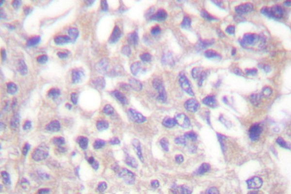 Phospho-alpha Adducin (Thr445) Antibody in Immunohistochemistry (Paraffin) (IHC (P))