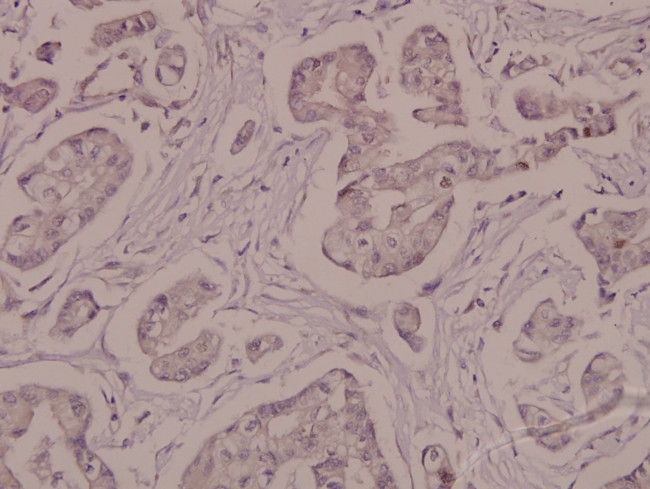 Phospho-ATP1A1 (Ser16) Antibody in Immunohistochemistry (Paraffin) (IHC (P))