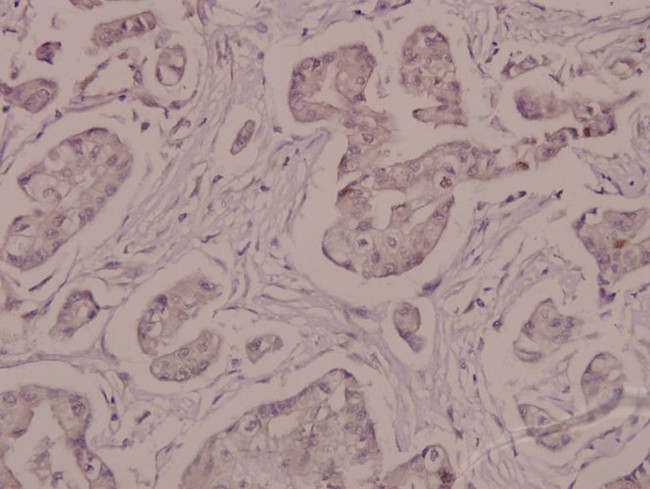 Phospho-ATP1A1 (Ser16) Antibody in Immunohistochemistry (Paraffin) (IHC (P))