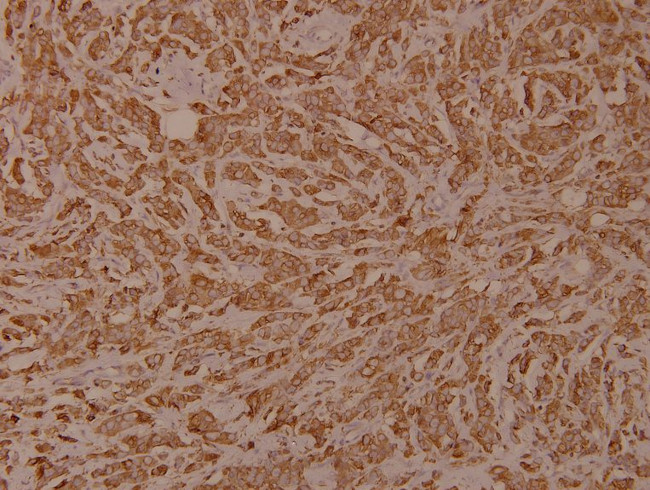 Phospho-Calnexin (Ser583) Antibody in Immunohistochemistry (Paraffin) (IHC (P))