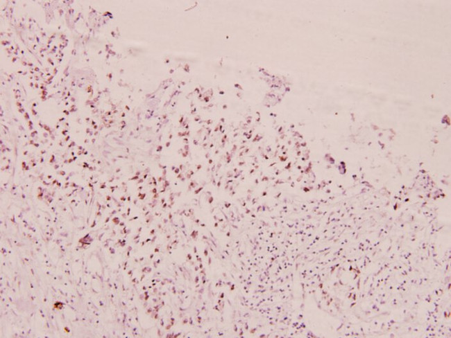 Phospho-FOXO1/FOXO3/FOXO4 (Thr24, Thr32) Antibody in Immunohistochemistry (Paraffin) (IHC (P))