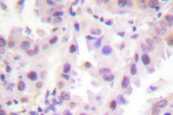 Phospho-ERF (Thr526) Antibody in Immunohistochemistry (Paraffin) (IHC (P))