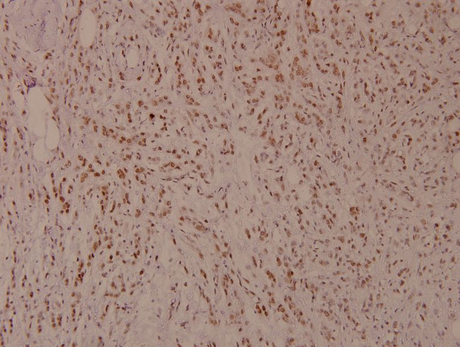 Phospho-MiTF (Ser180) Antibody in Immunohistochemistry (Paraffin) (IHC (P))
