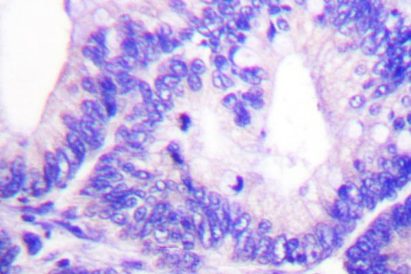 Phospho-WAVE1 (Tyr125) Antibody in Immunohistochemistry (Paraffin) (IHC (P))