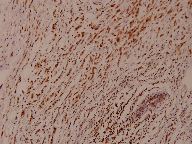 Phospho-AMPK alpha-1,2 (Thr172, Thr183) Antibody in Immunohistochemistry (Paraffin) (IHC (P))