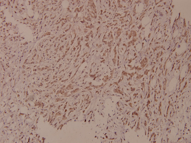 Phospho-PLCG1 (Tyr771) Antibody in Immunohistochemistry (Paraffin) (IHC (P))