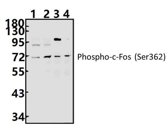 Phospho-c-Fos (Ser362) Antibody in Western Blot (WB)