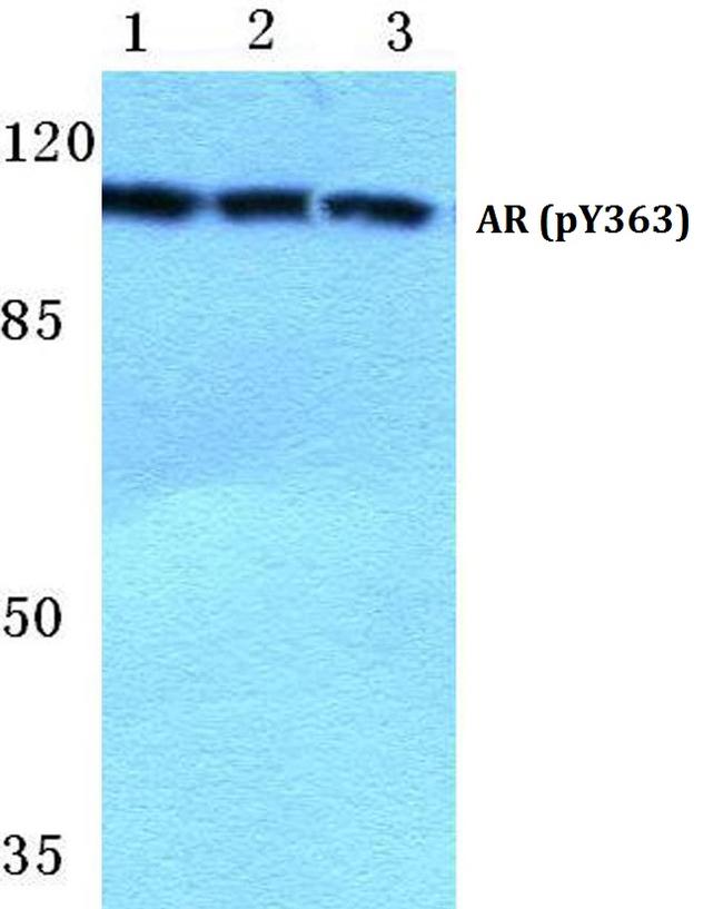 Phospho-Androgen Receptor (Tyr363) Antibody in Western Blot (WB)