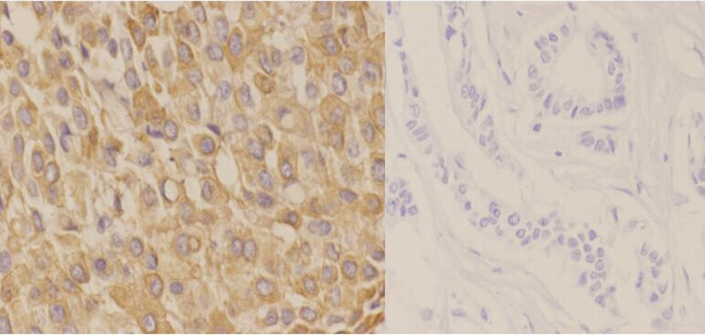Phospho-Cytokeratin 18 (Ser52) Antibody in Immunohistochemistry (Paraffin) (IHC (P))