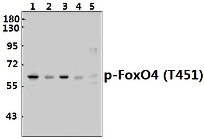 Phospho-FOXO4 (Thr451) Antibody in Western Blot (WB)