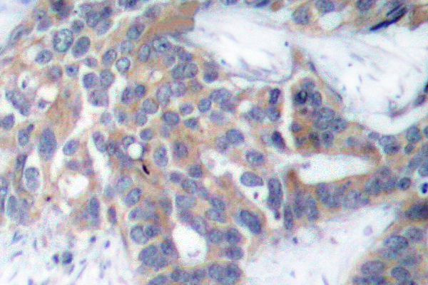 Phospho-MEK1/MEK2 (Ser218, Ser222) Antibody in Immunohistochemistry (Paraffin) (IHC (P))