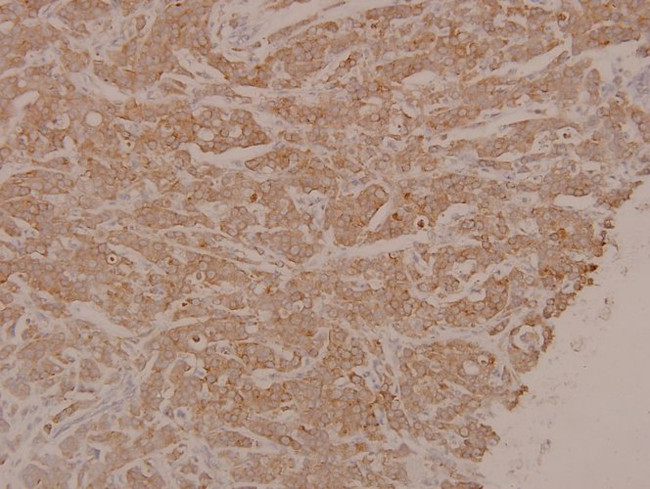 Phospho-MEK1/MEK2 (Ser222, Ser226) Antibody in Immunohistochemistry (Paraffin) (IHC (P))