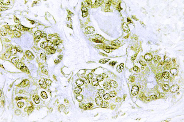Phospho-IkB alpha (Tyr42) Antibody in Immunohistochemistry (Paraffin) (IHC (P))