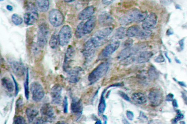 Phospho-beta Catenin (Ser33) Antibody in Immunohistochemistry (Paraffin) (IHC (P))