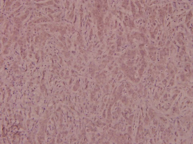 Phospho-IRS1 (Ser639) Antibody in Immunohistochemistry (Paraffin) (IHC (P))