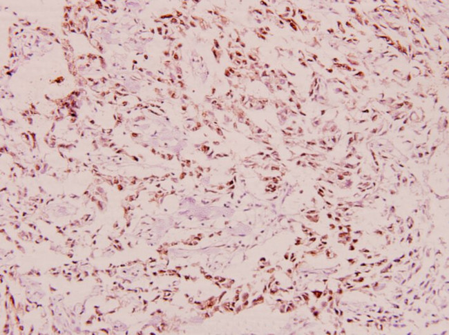 Phospho-BRCA1 (Ser1423) Antibody in Immunohistochemistry (Paraffin) (IHC (P))