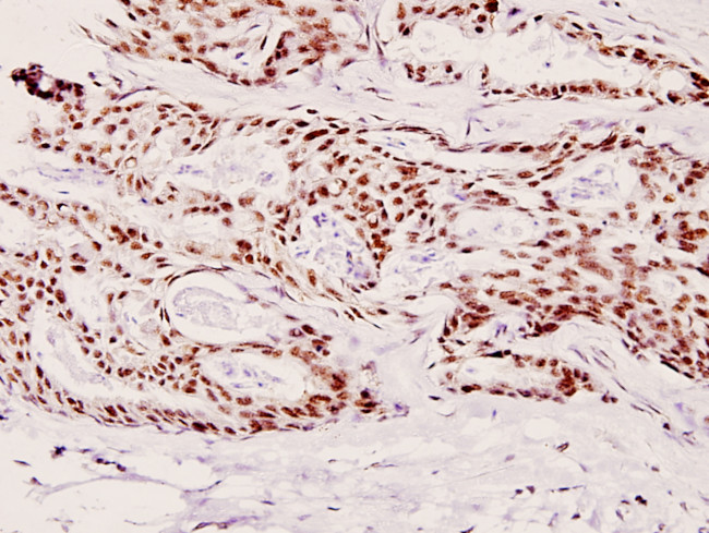 Phospho-p70 S6 Kinase (Thr421) Antibody in Immunohistochemistry (Paraffin) (IHC (P))