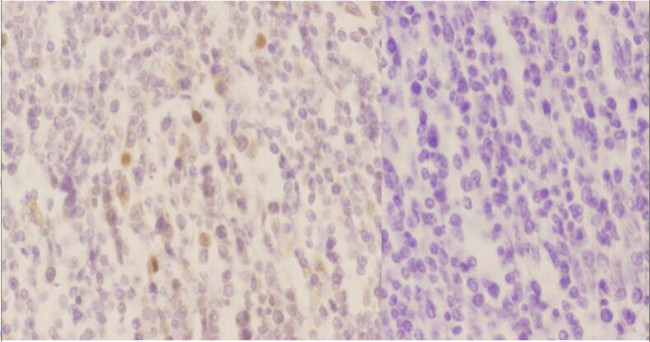 Phospho-RelB (Ser552) Antibody in Immunohistochemistry (Paraffin) (IHC (P))