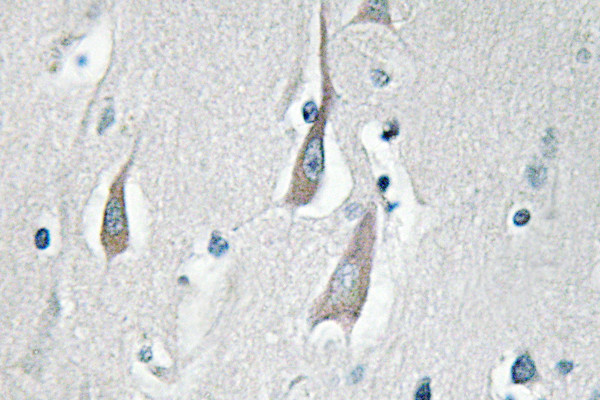 Phospho-CaMKII alpha/delta (Thr286) Antibody in Immunohistochemistry (Paraffin) (IHC (P))
