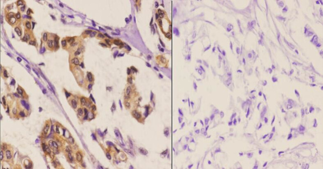 Phospho-HSF1 (Ser303) Antibody in Immunohistochemistry (Paraffin) (IHC (P))