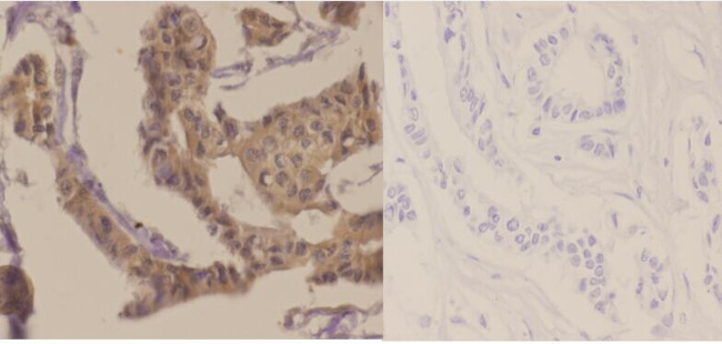 Phospho-p70 S6 Kinase (Thr421) Antibody in Immunohistochemistry (Paraffin) (IHC (P))