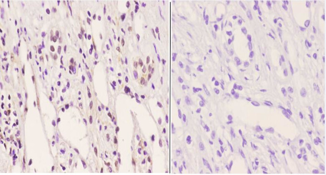 Phospho-PFKFB2 (Ser483) Antibody in Immunohistochemistry (Paraffin) (IHC (P))