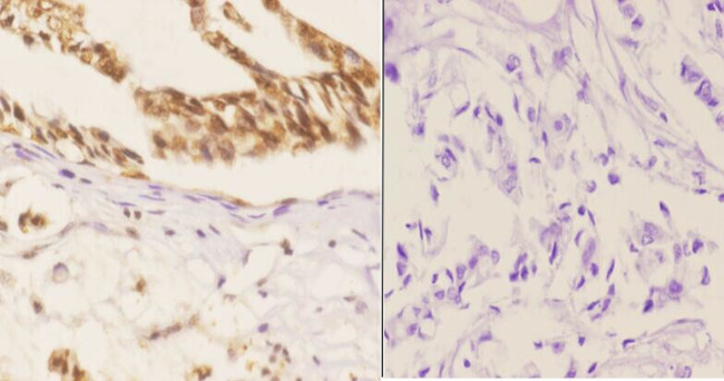 Phospho-SMAD1 (Ser187) Antibody in Immunohistochemistry (Paraffin) (IHC (P))