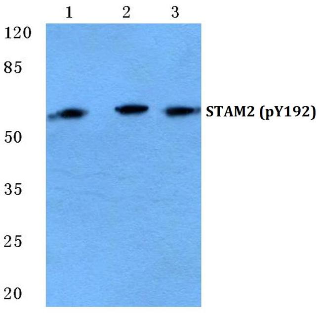 Phospho-STAM2 (Tyr192) Antibody in Western Blot (WB)