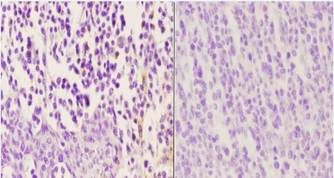 Phospho-Zap-70 (Tyr315) Antibody in Immunohistochemistry (Paraffin) (IHC (P))