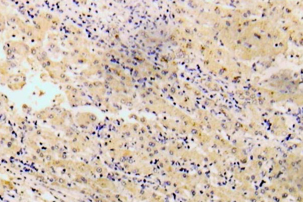 Phospho-GAB1 (Tyr627) Antibody in Immunohistochemistry (Paraffin) (IHC (P))