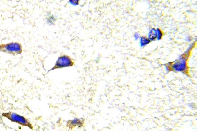 LIMK1/LIMK2 Antibody in Immunohistochemistry (Paraffin) (IHC (P))