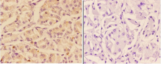 Adenylate Cyclase 9 Antibody in Immunohistochemistry (Paraffin) (IHC (P))