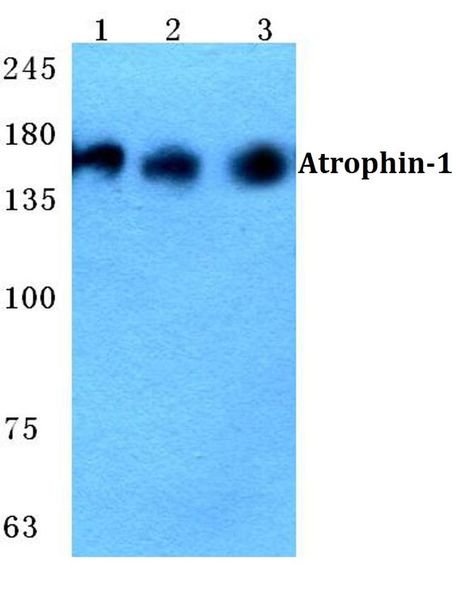 Atrophin 1 Antibody in Western Blot (WB)