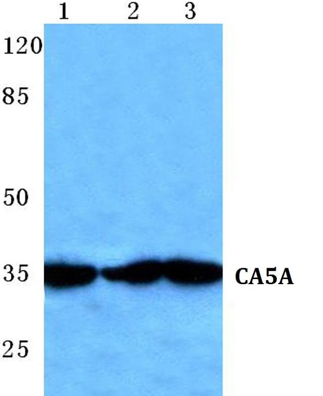 Carbonic Anhydrase VA Antibody in Western Blot (WB)
