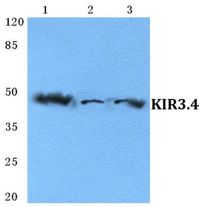 Kir3.4 (KCNJ5) Antibody in Western Blot (WB)