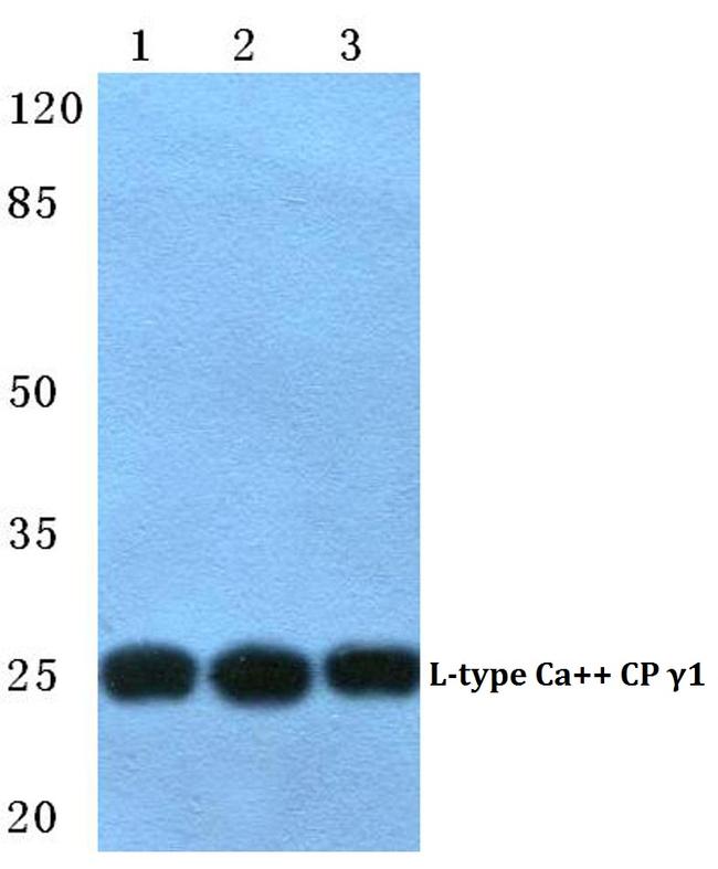 CACNG1 Antibody in Western Blot (WB)