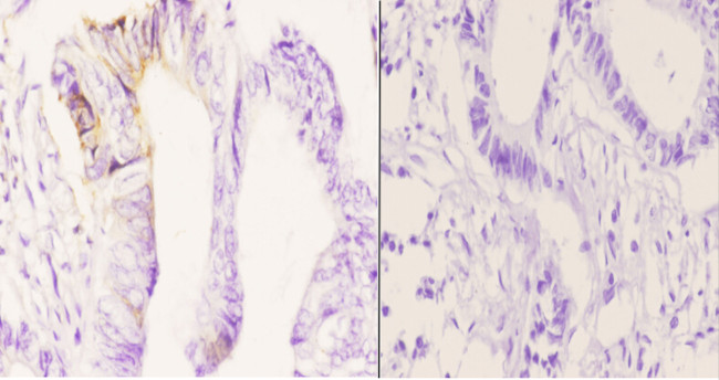 MAST4 Antibody in Immunohistochemistry (Paraffin) (IHC (P))