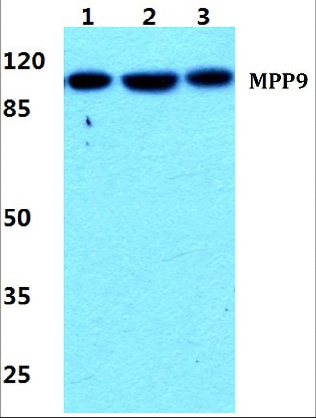 MPP9 Antibody in Western Blot (WB)