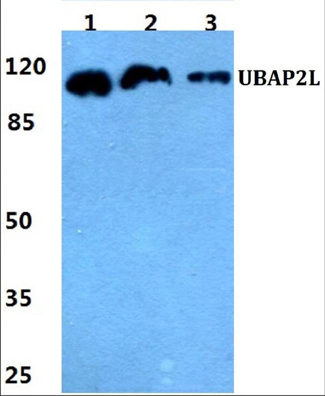 UBAP2L Antibody in Western Blot (WB)
