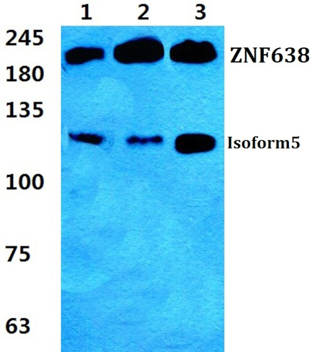 ZNF638 Antibody in Western Blot (WB)