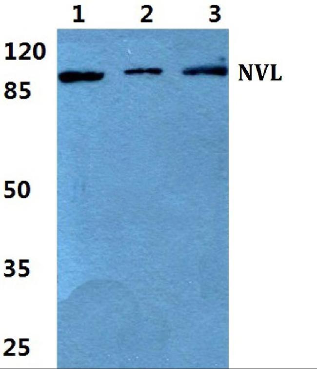 NVL Antibody in Western Blot (WB)
