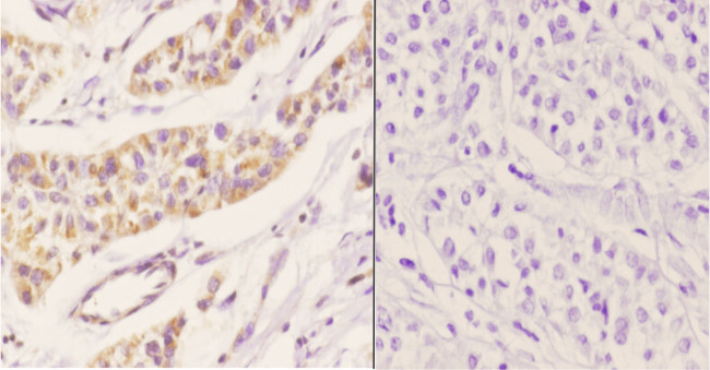 PEX11B Antibody in Immunohistochemistry (Paraffin) (IHC (P))